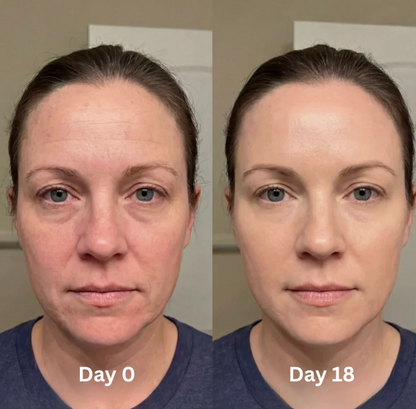 Bevalora® Tremella Skin Hydration Powder